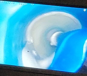 Sewer Line Repair Service